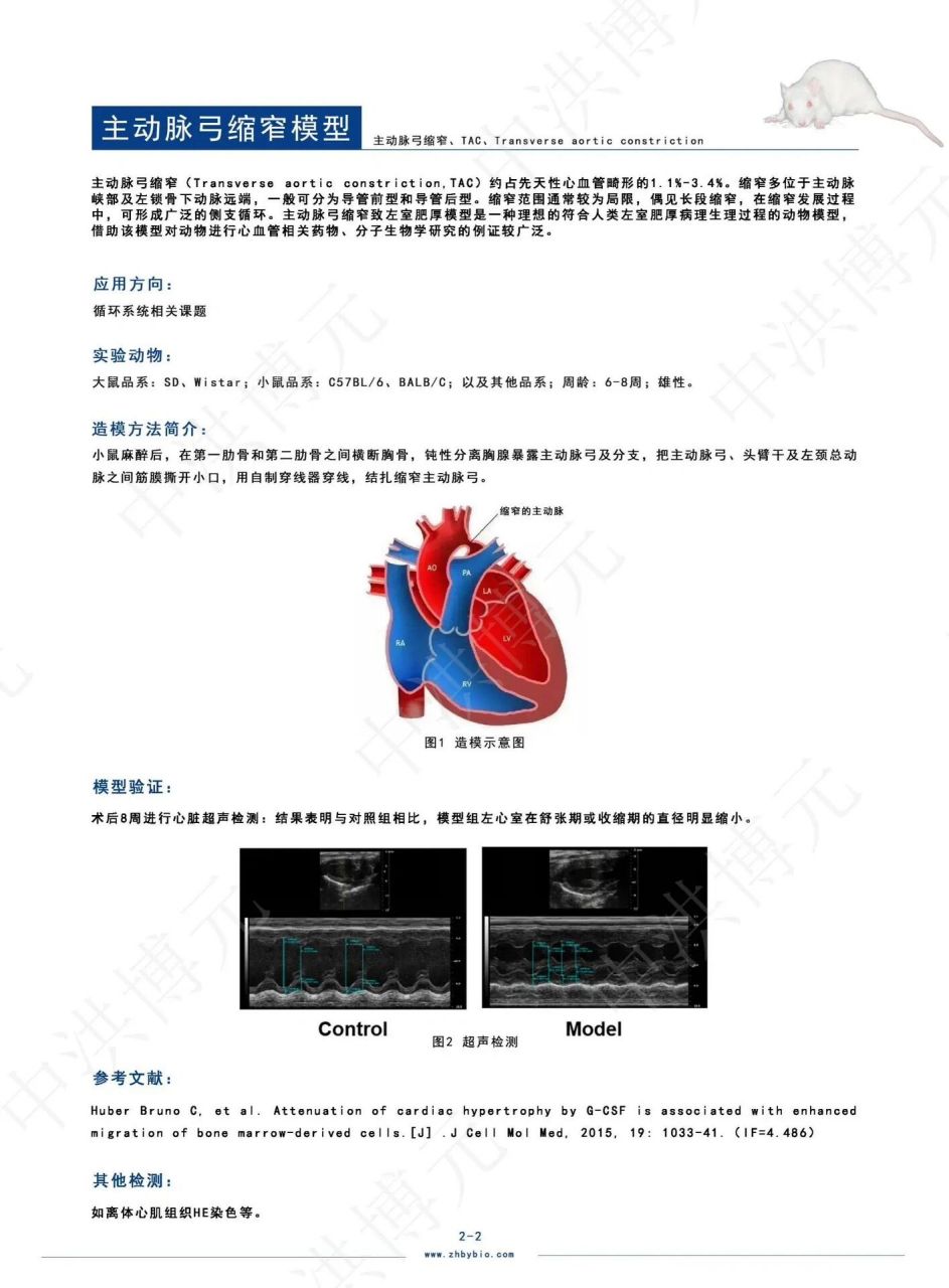 主动脉瓣上缩窄图片