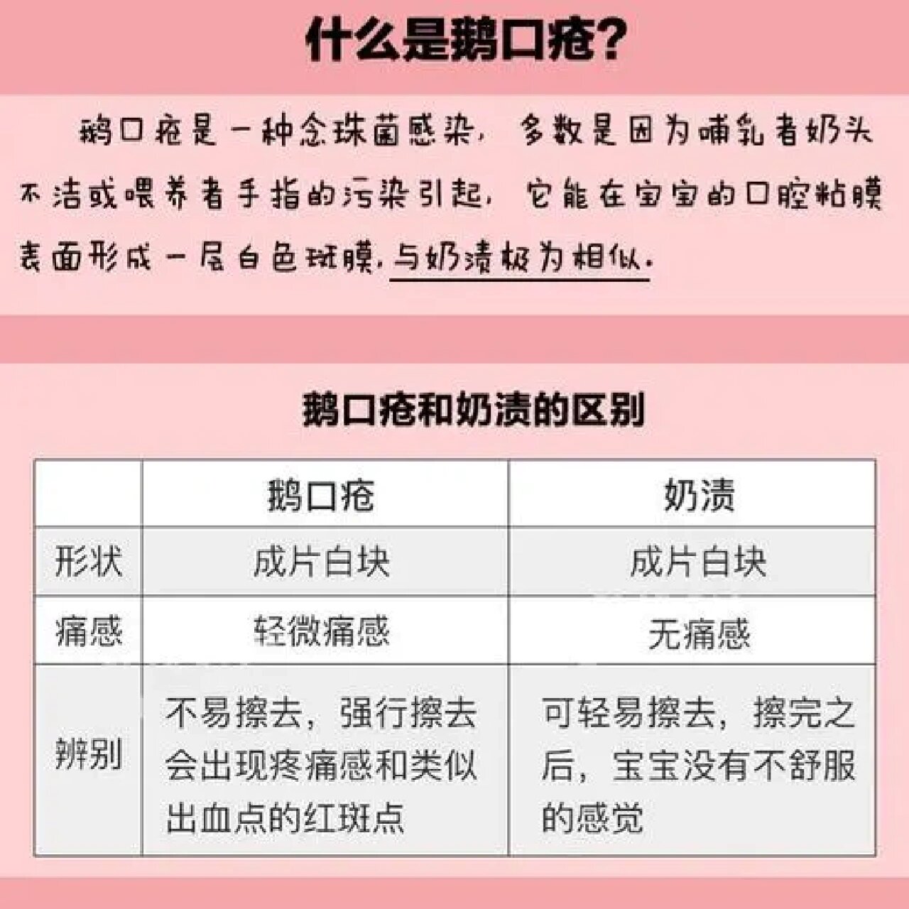 鹅口疮是什么原因图片