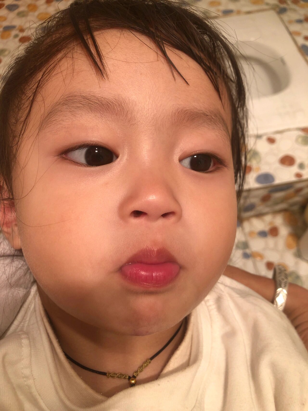 才两岁的女宝宝怎么会长一圈这么黑的胡子?