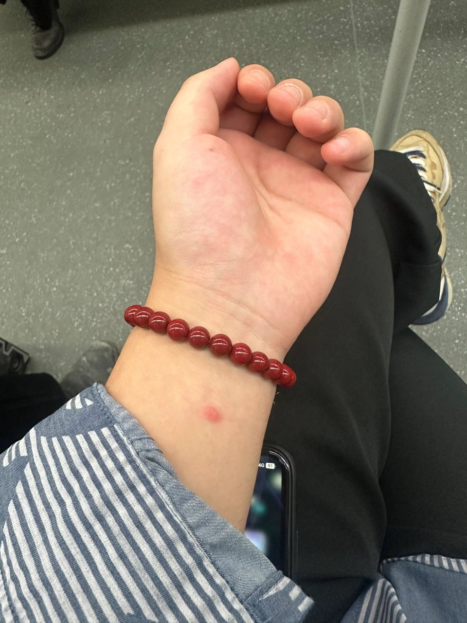 想问一下大家,你们的守宫砂也是这样的吗?