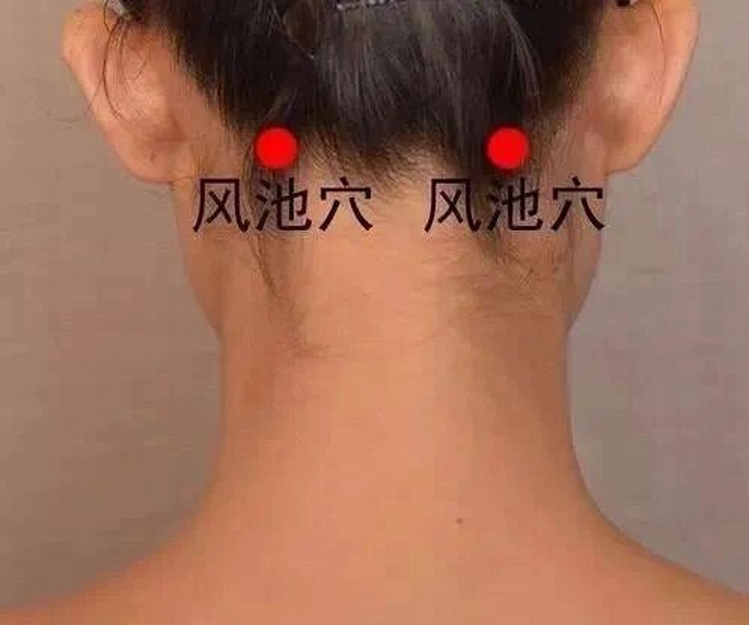 【风池穴】缓解头晕头痛 风池穴是一个祛风散寒,疏解头部经络,治疗