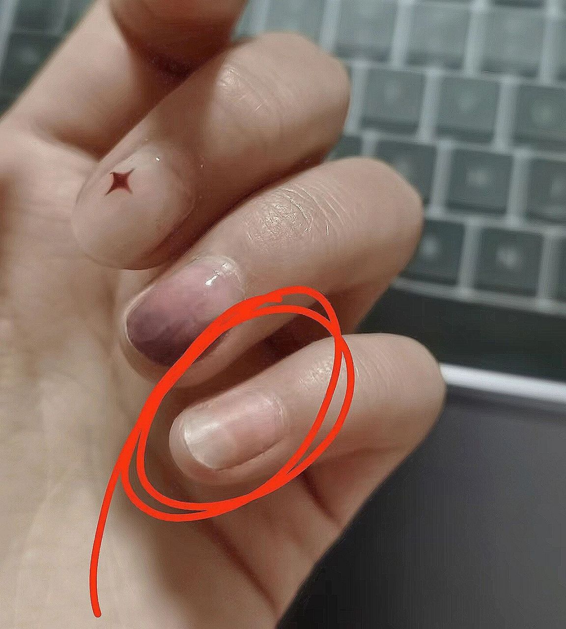 空甲应该怎么办呀呜呜01 做的美甲感觉有点疼,卸甲之后发现有5个