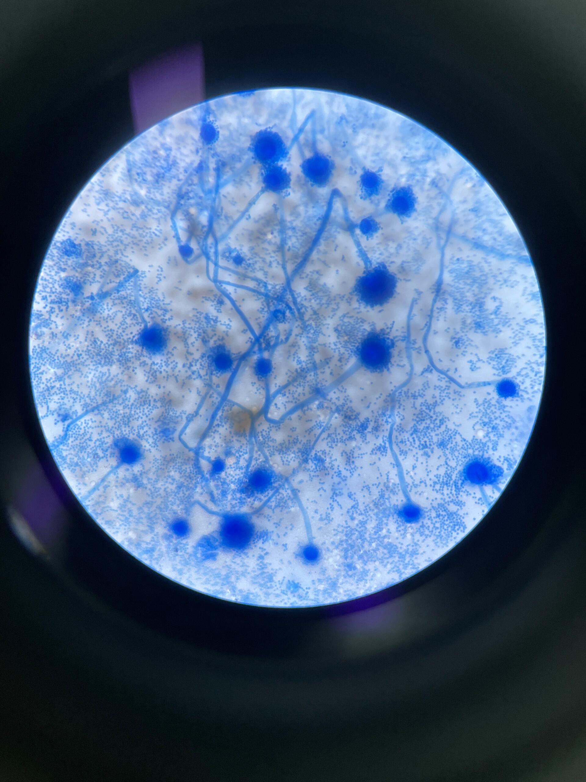 检验记录95:曲霉菌 显微镜下的曲霉菌——蓝色向日葵97