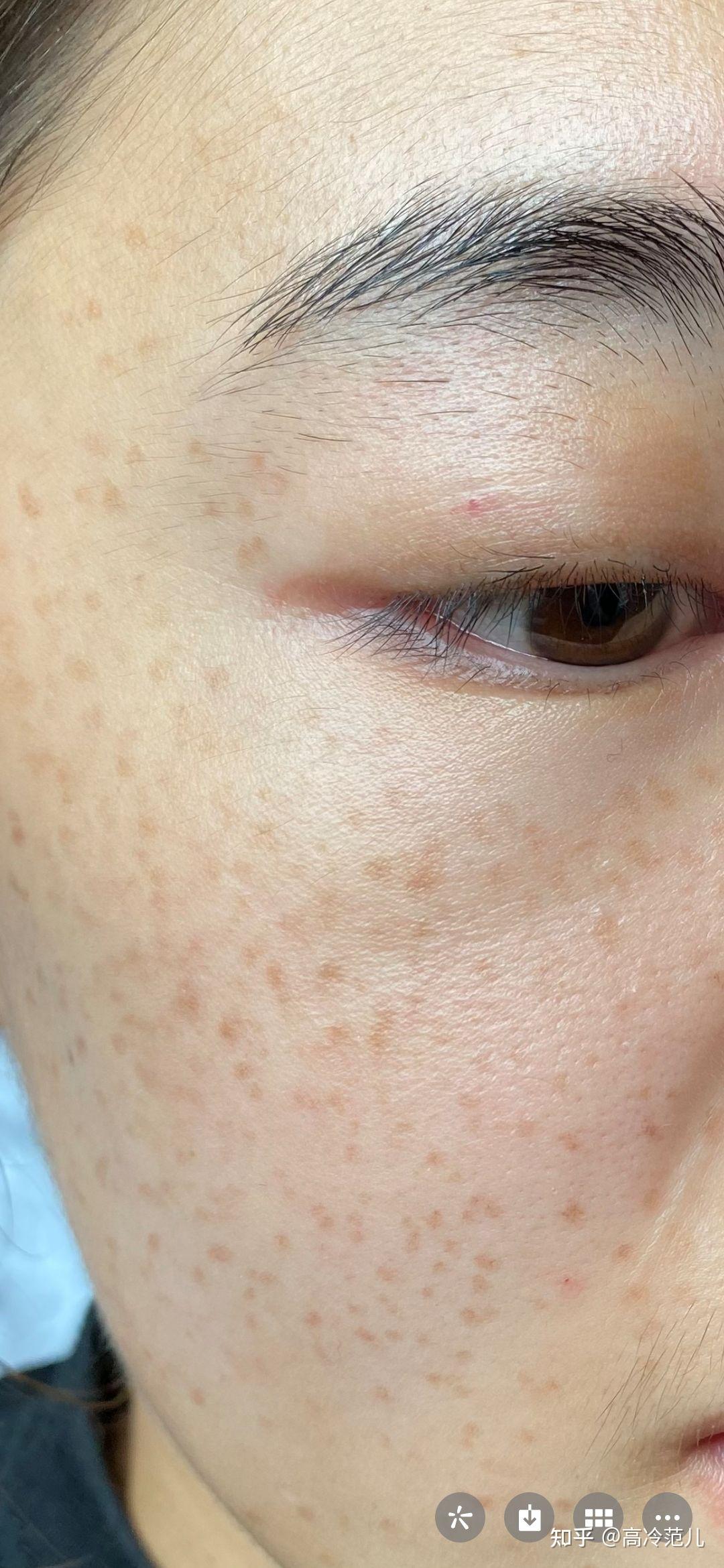 不想看我的麻子脸啦
