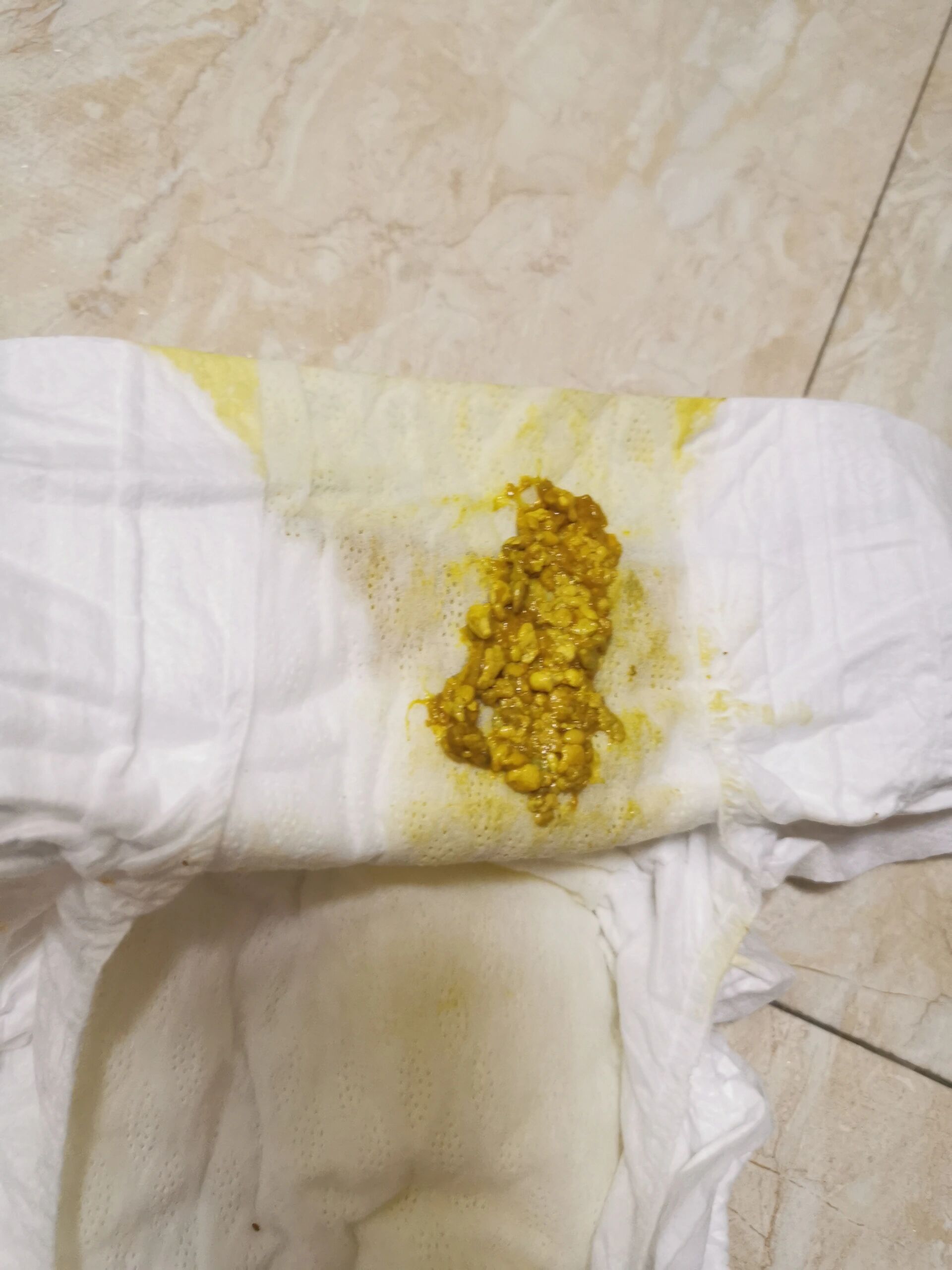 屎里有奶瓣,换什么奶粉好