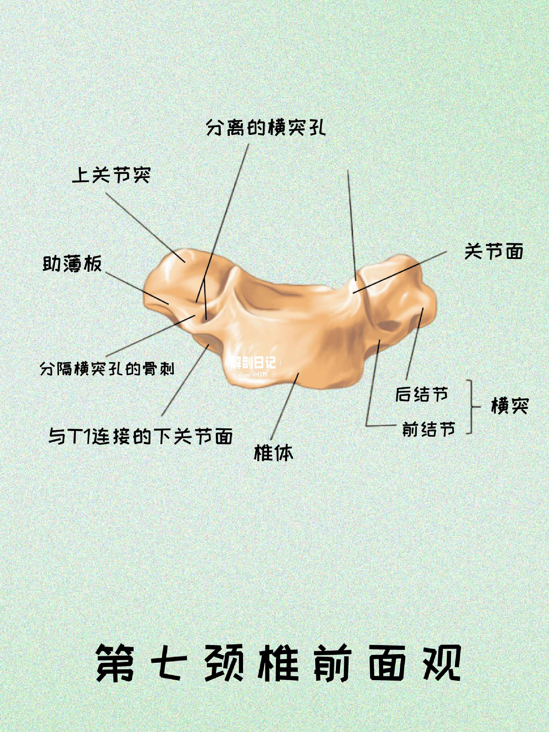 隆椎又称为第七颈椎