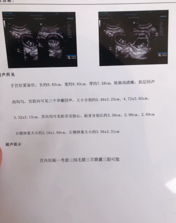 的现象,主要是这三个原因导致的: