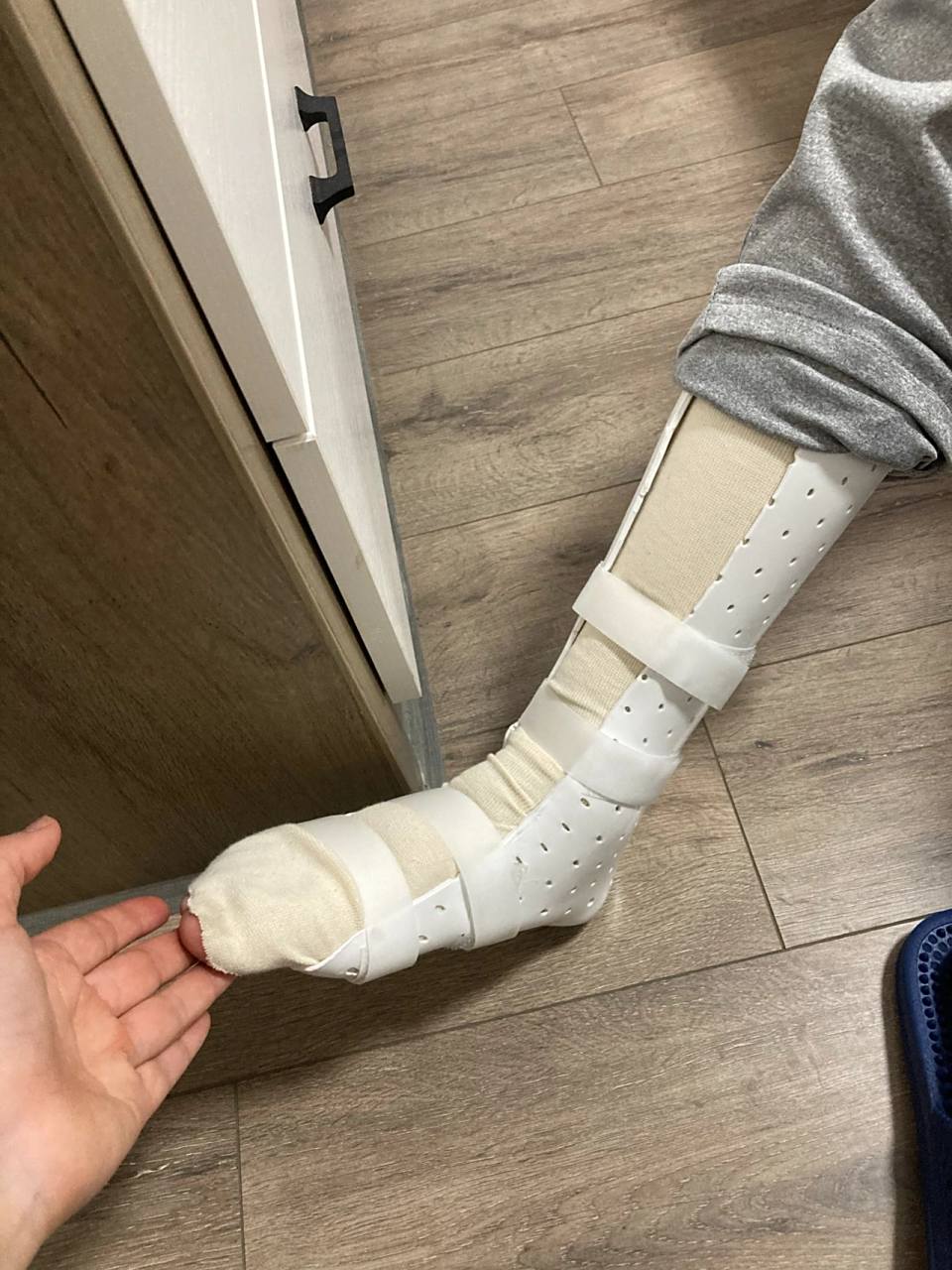 高分子石膏的价格 市级人民医院,1400元不开票的价格,开票是1600元,打