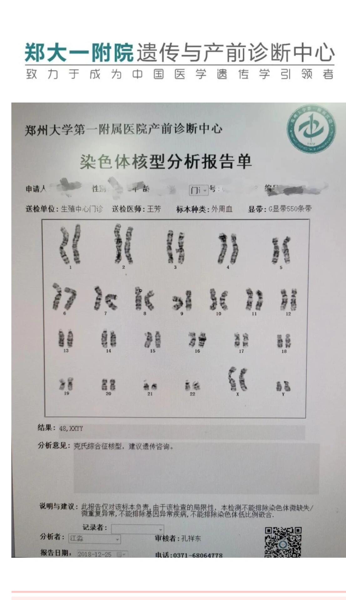 染色体异常～性染色体异常 除了造成21三体综合征