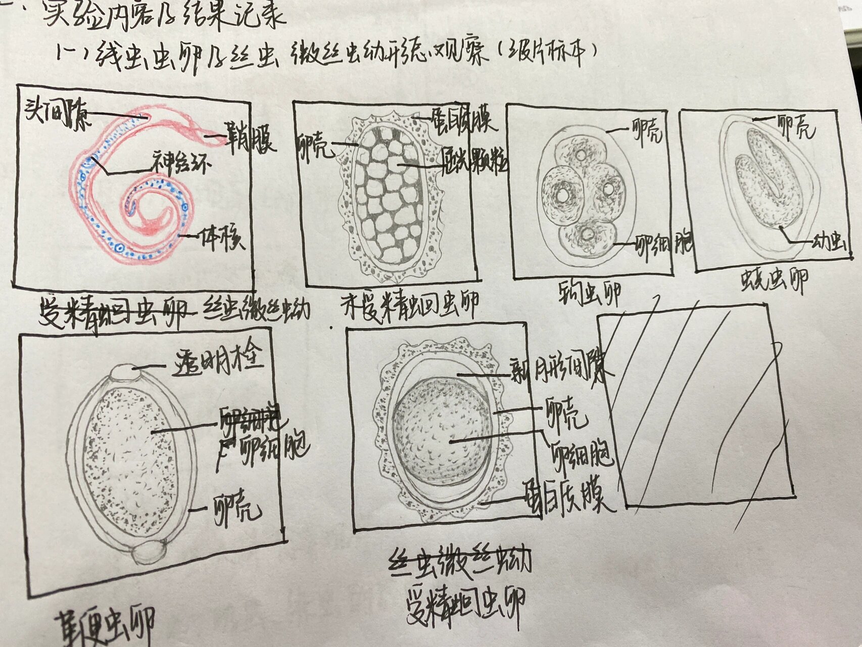 检验人看过来/寄生虫形态红蓝铅笔绘图