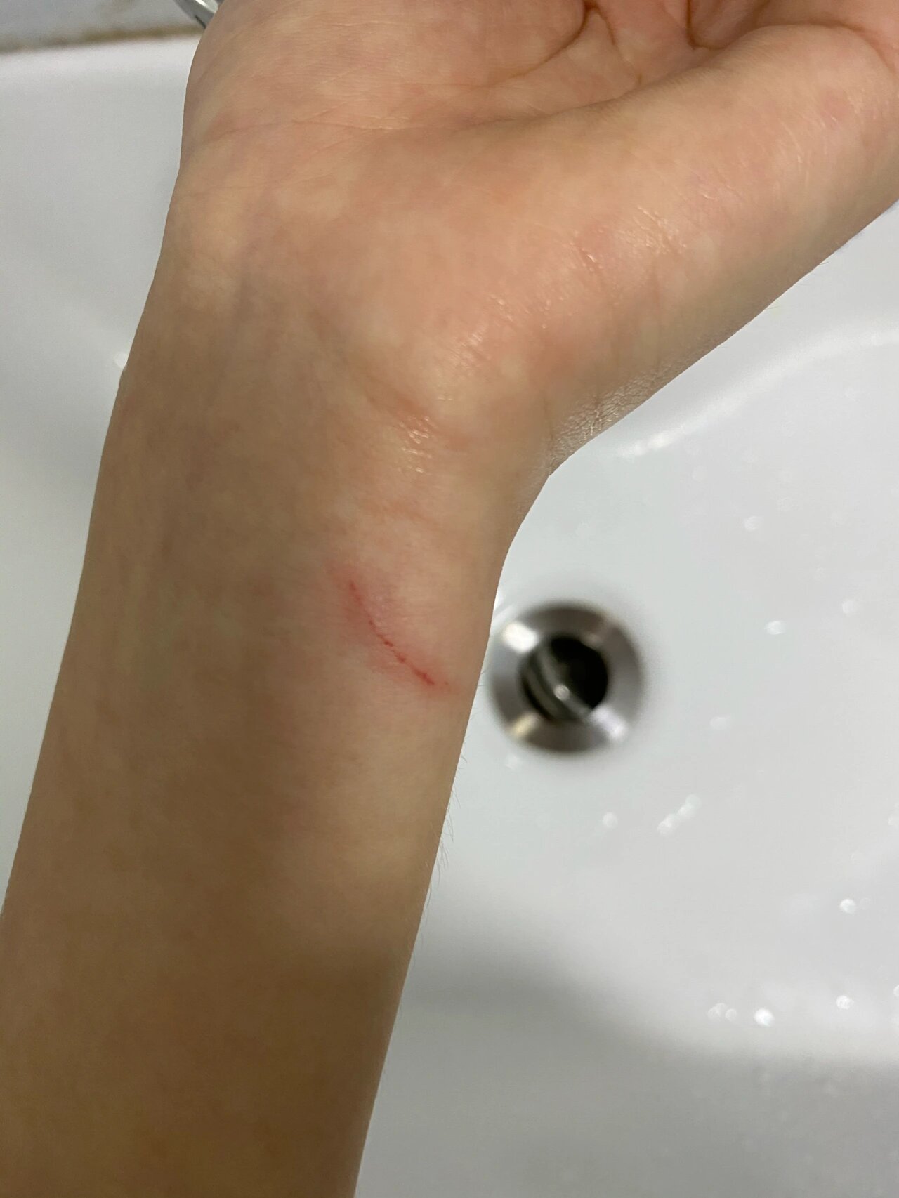 被家里狗狗抓伤 这种程度需要打针吗