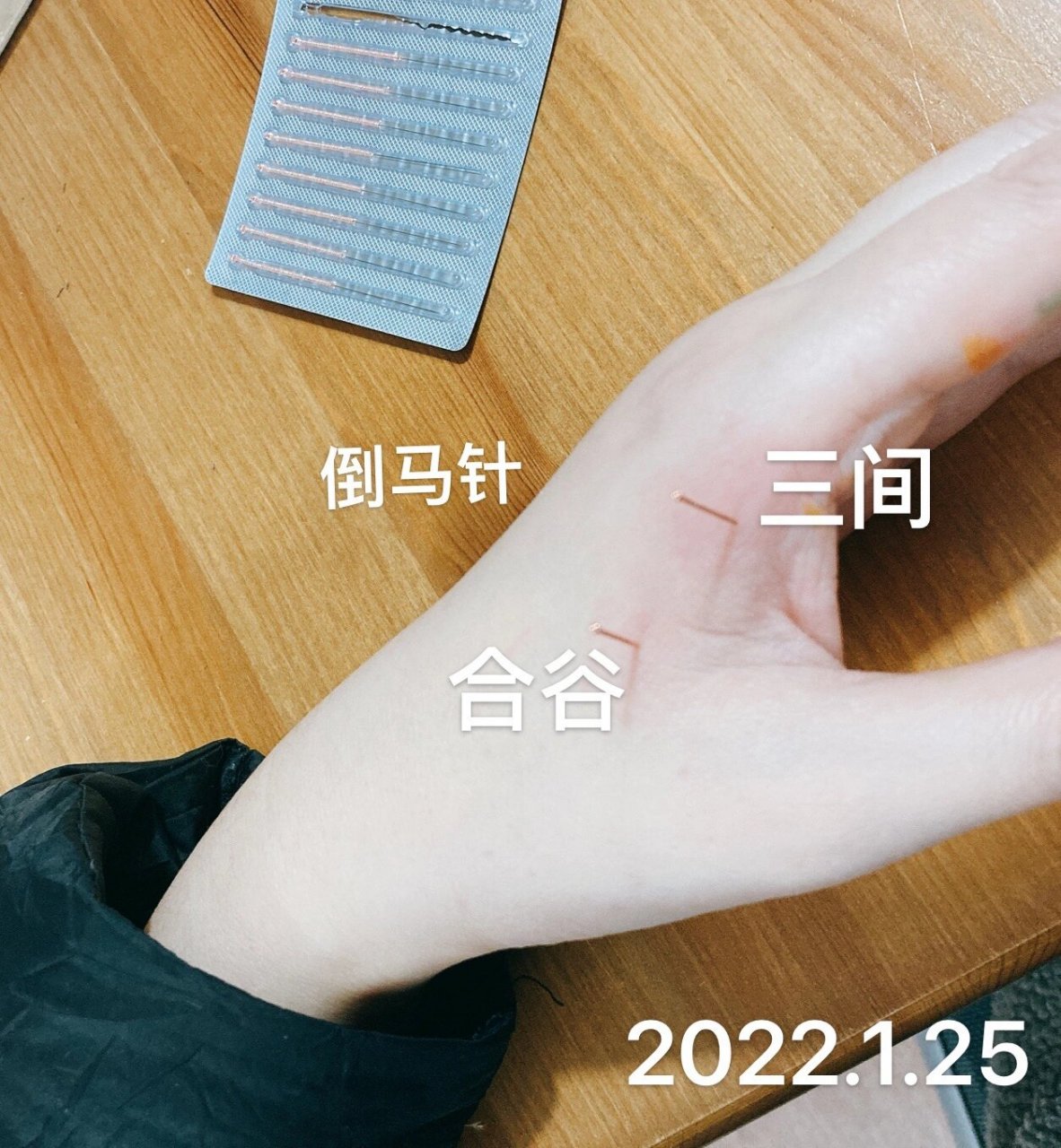针灸练习第5周 练习灵龟八法 晚上课 先后溪配申脉 然后照海配列缺 1.