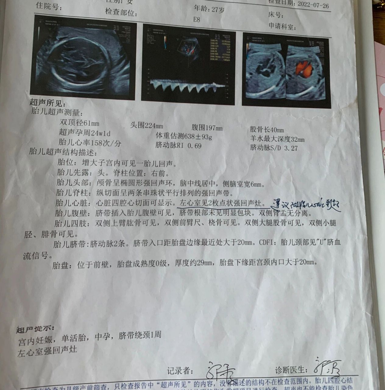 胎儿心脏彩超 左心室两枚强光斑 23周多做的四维,医生说有这句话就