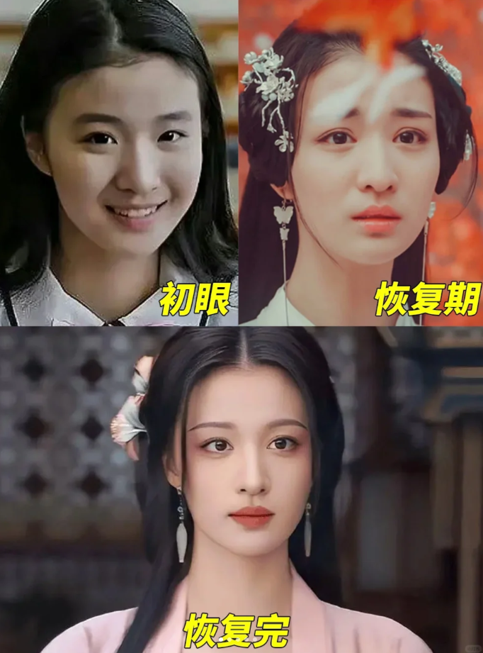 王楚然从出道到现在最明显的变化就是眼睛,将军在上的表妹真的有被