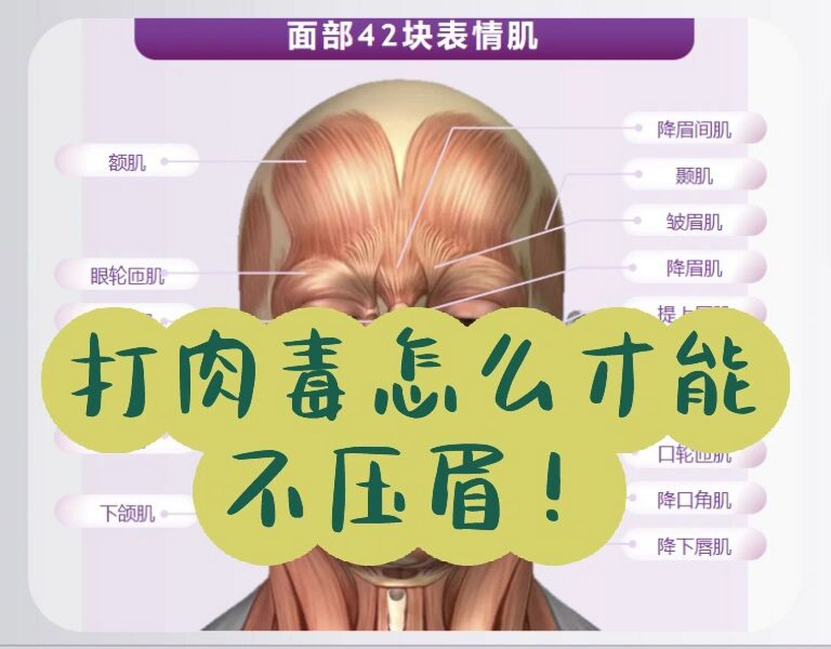 打肉毒如何不压眉?