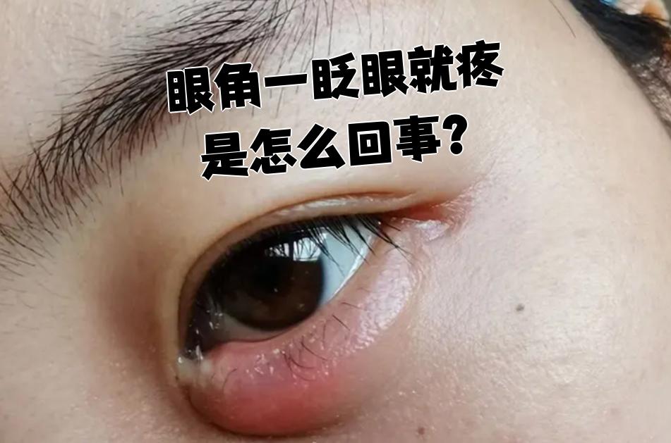 眼角一眨眼就疼,常见的原因有下面几种: