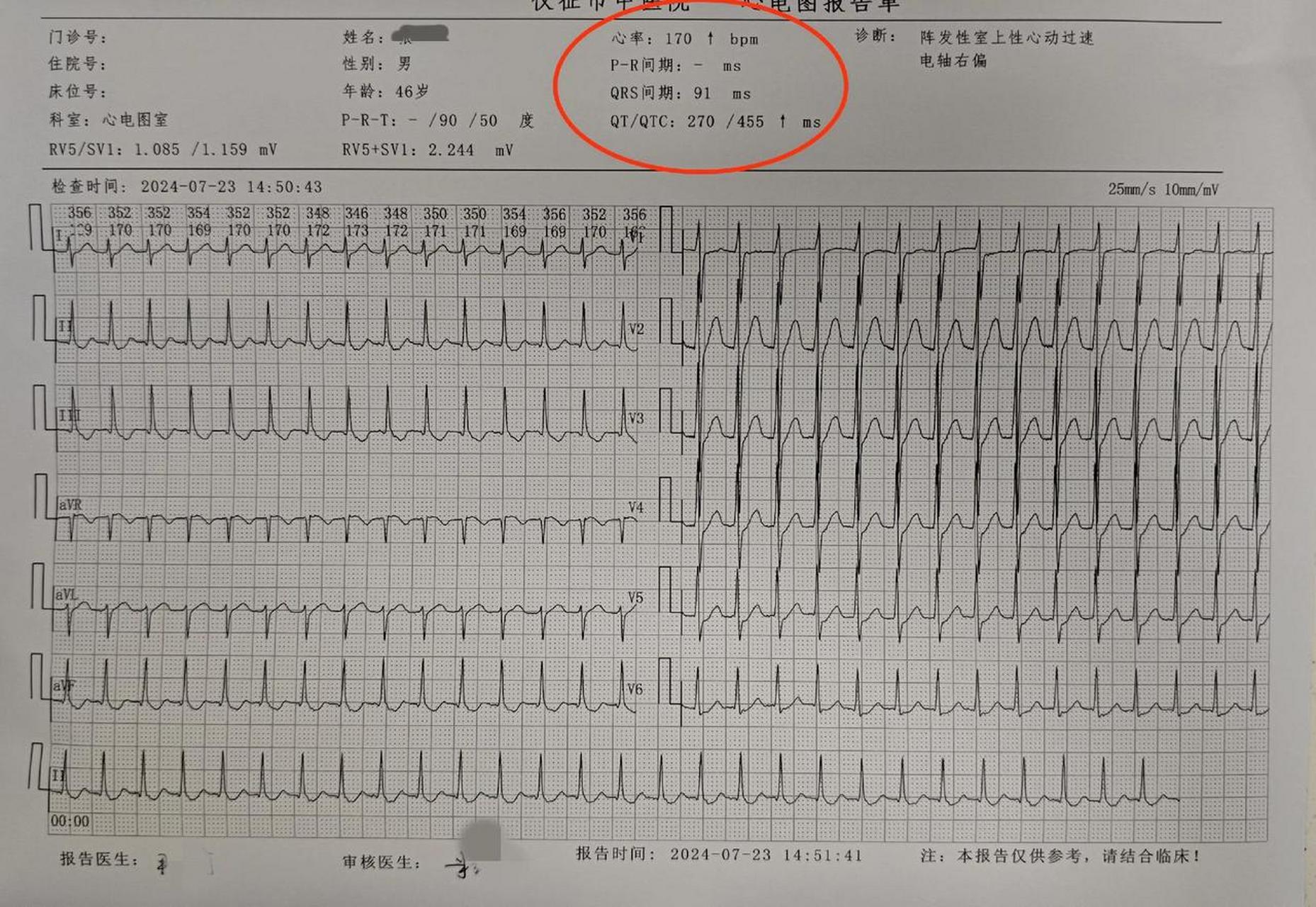 不管怎么样,先把心率转到正常再说!