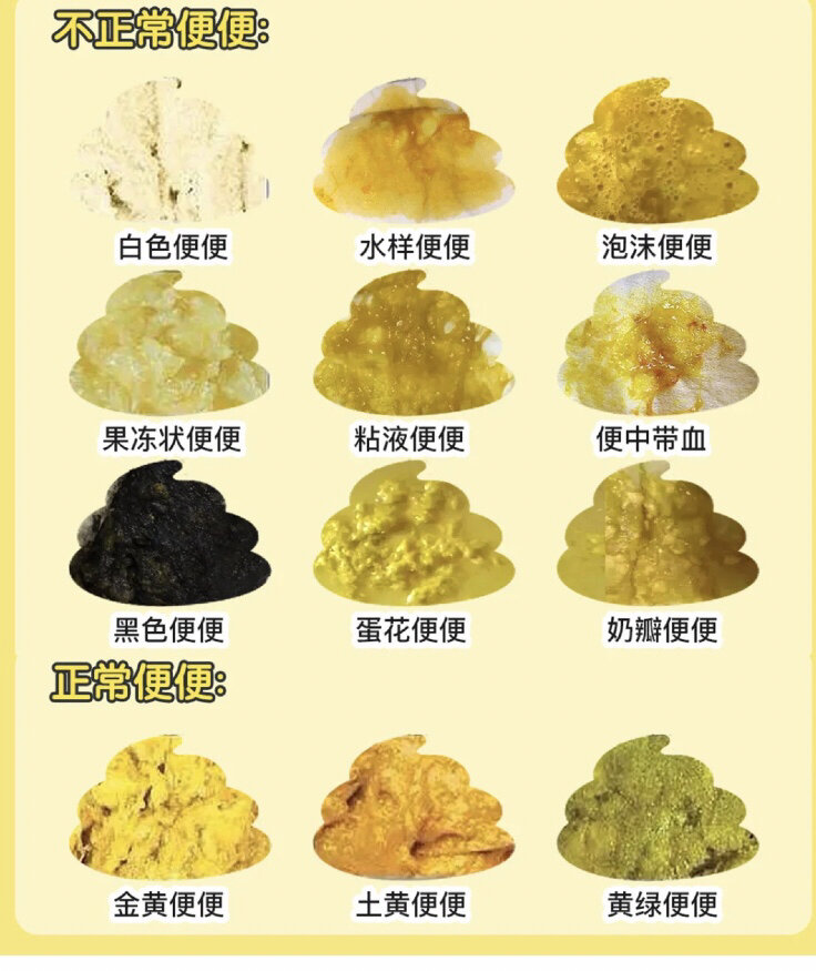 小儿腹泻是由多种病原及多种病因而引起的一种病