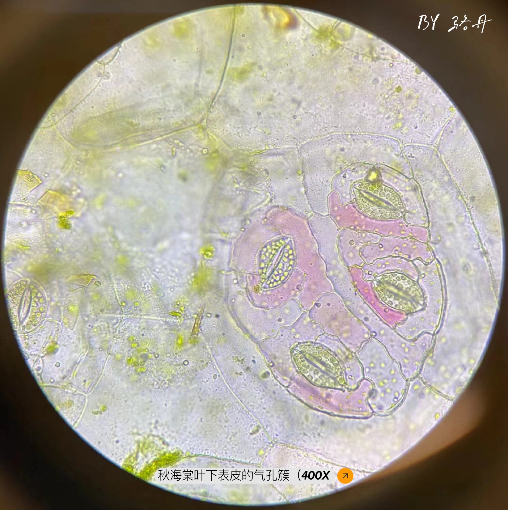 动物细胞有液泡吗图片