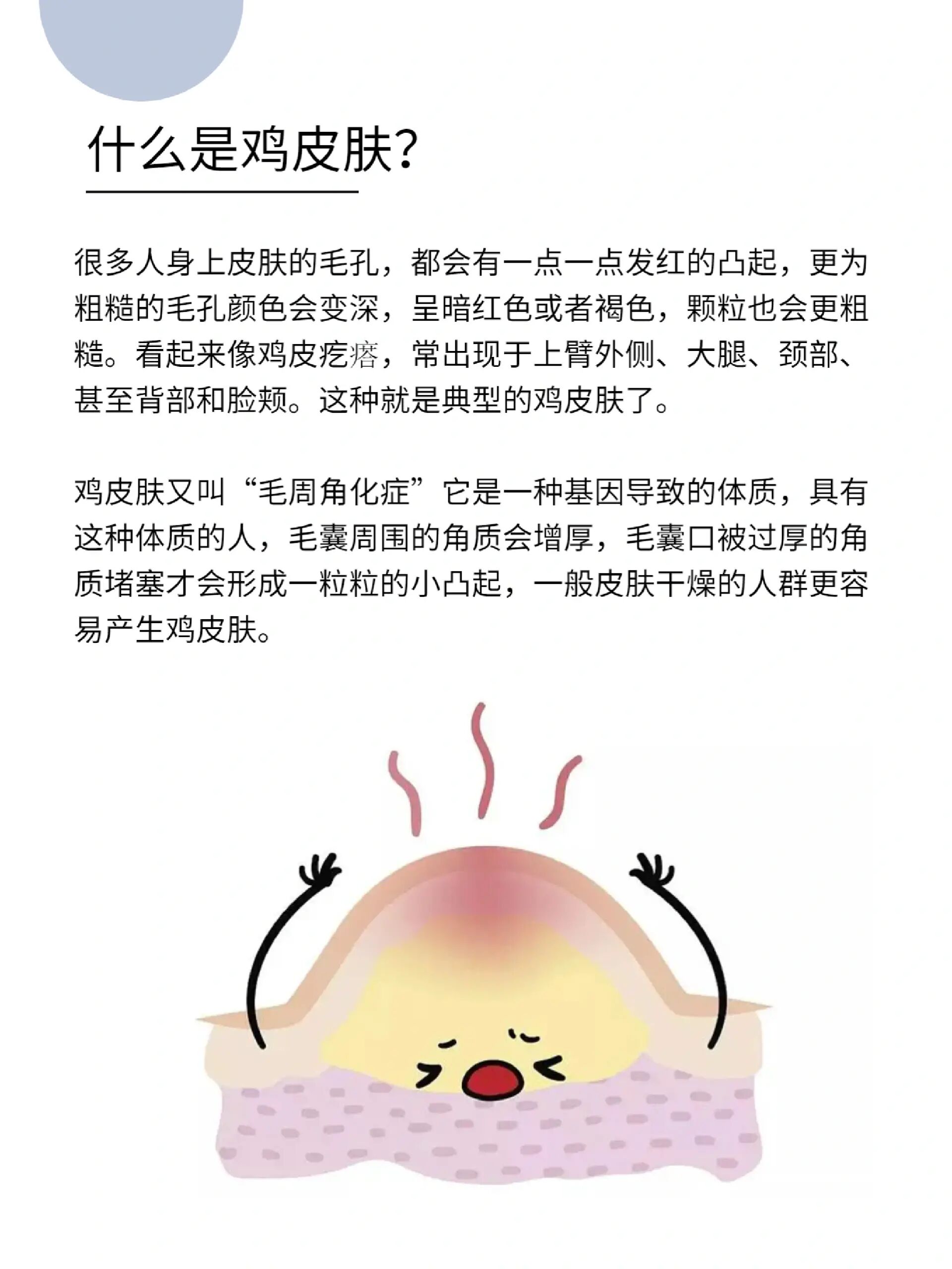 怎么改善鸡皮肤71皮肤管理师必看  鸡皮肤也叫毛周角化,这种颗粒不