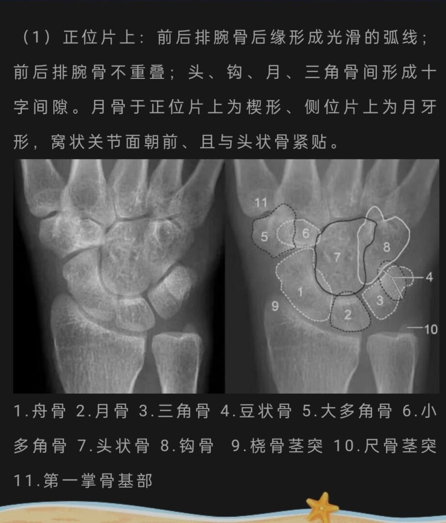 腕关节x线解剖