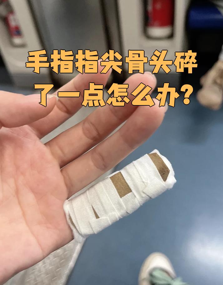 手指尖骨头碎了一点,这种情况通常是因为外伤,比如被门夹到或者砸伤