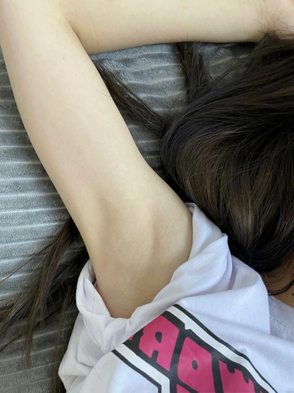 腋窝黑?来试试这个方法吧