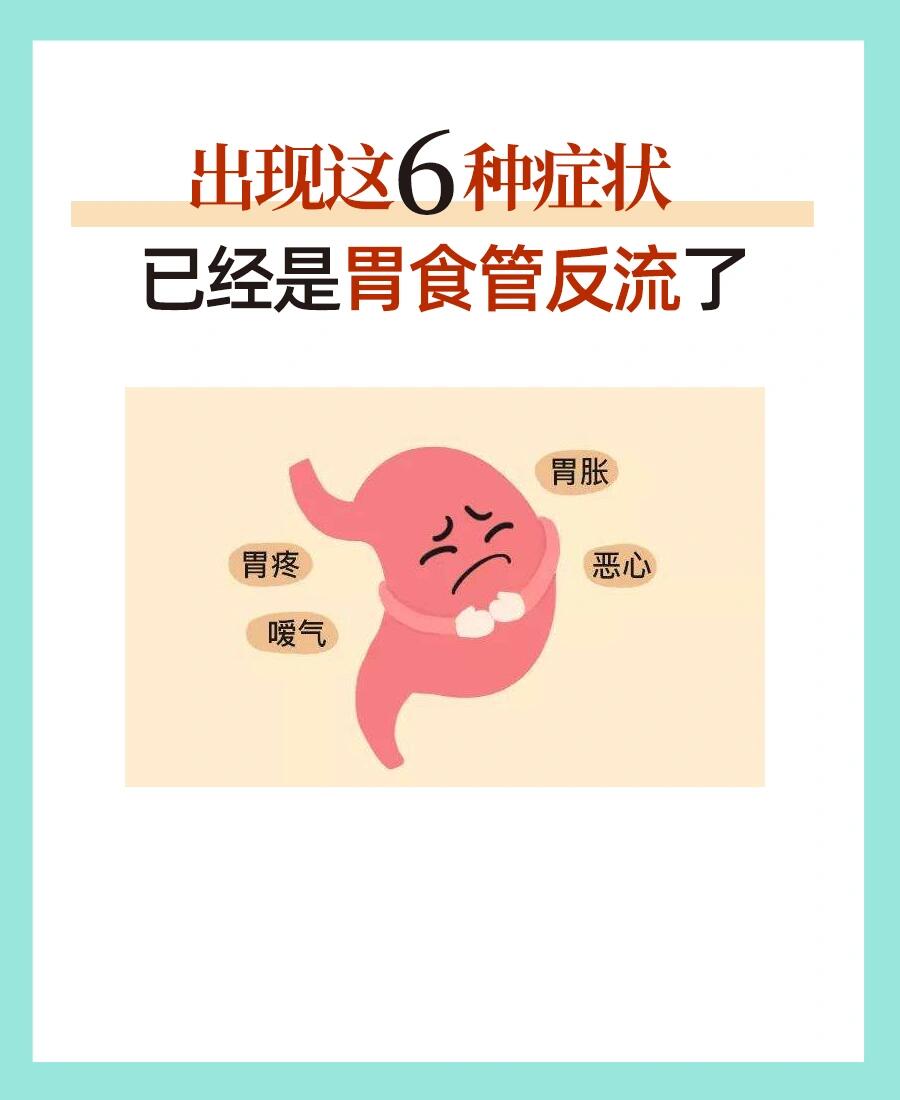 出现这6种症状,已经是胃食管反流了 出现这6种症状,已经是胃食管反流