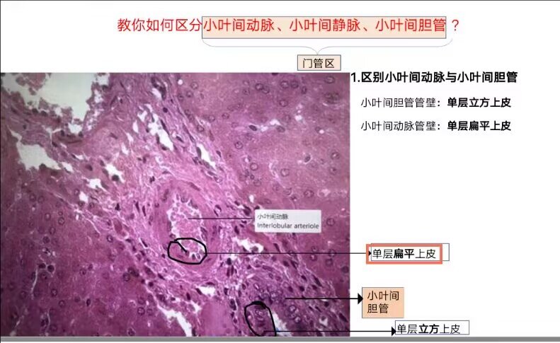 小叶间动脉图片图片