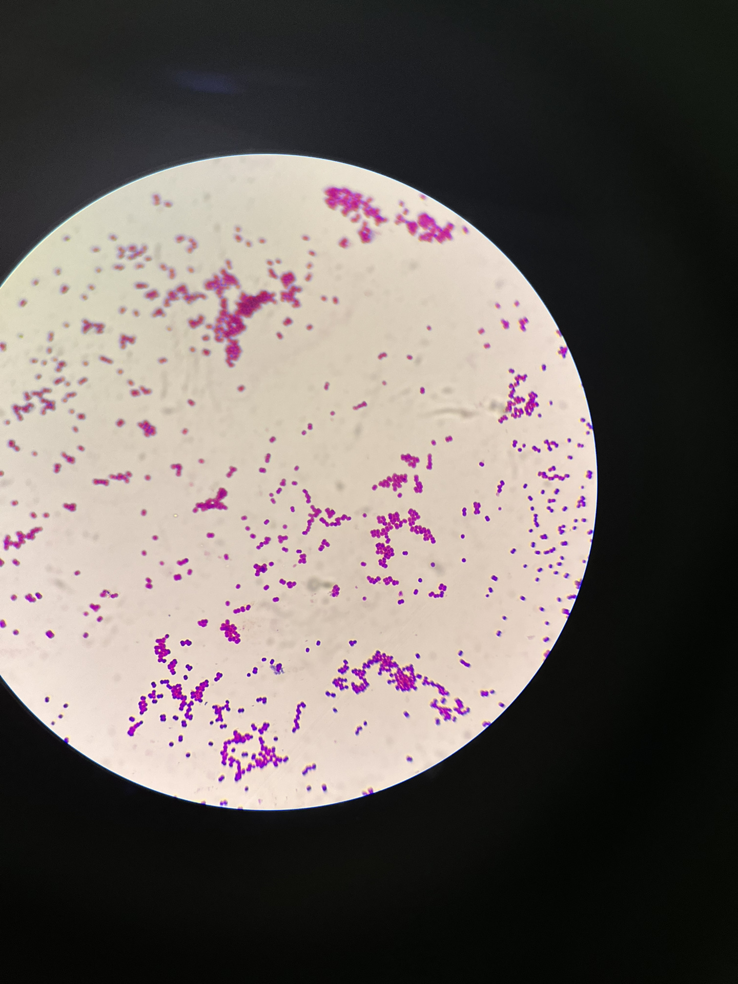 每日一种菌  卡他莫拉菌 原为布兰菌属后划分为莫拉菌属 各位微生物的