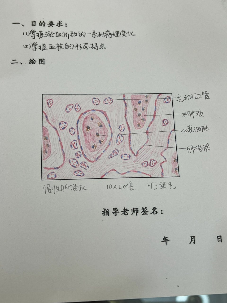 肺淤血绘图图片