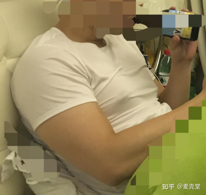 男性胸大胸部脂肪过多乳头尖尖乳房发育怎么办除锻炼改善以外可从外部