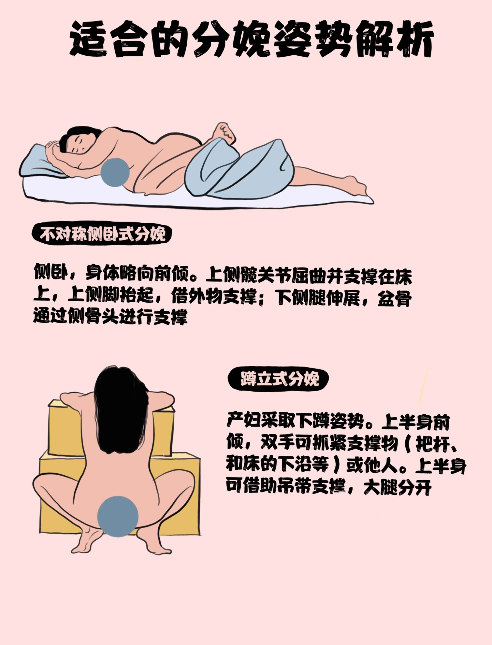 孕妇生孩子姿势图片