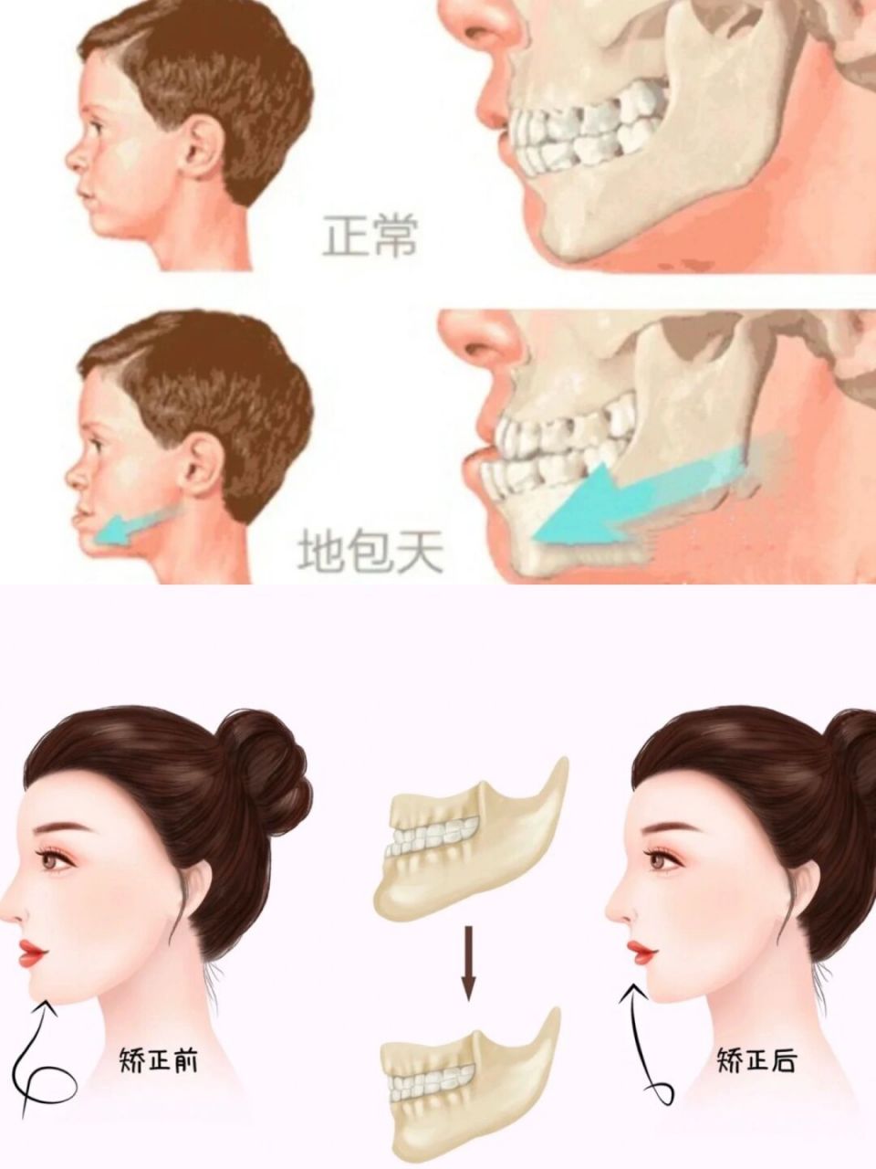 地包天自救图片