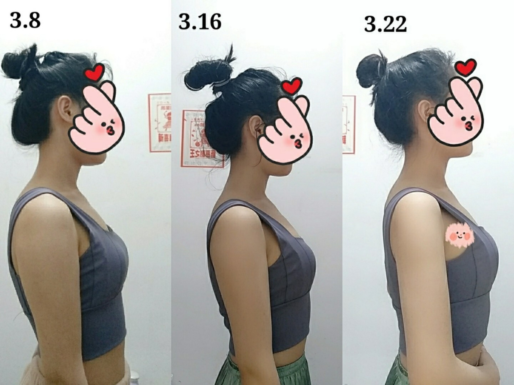 驼背改善‖15天对比图来啦! 打卡改善驼背的第15天!