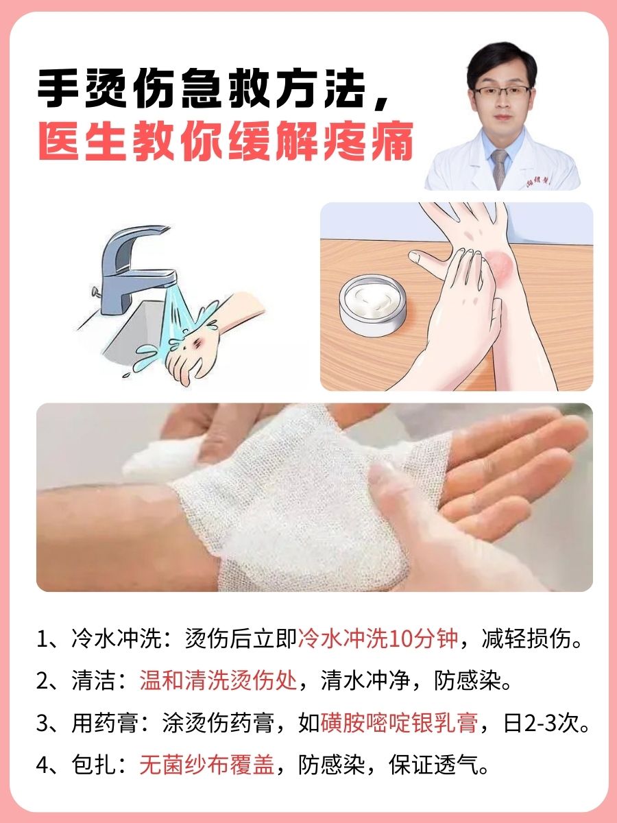 手烫伤急救方法,医生教你缓解疼痛 在日常生活中,不小心烫伤是常有的
