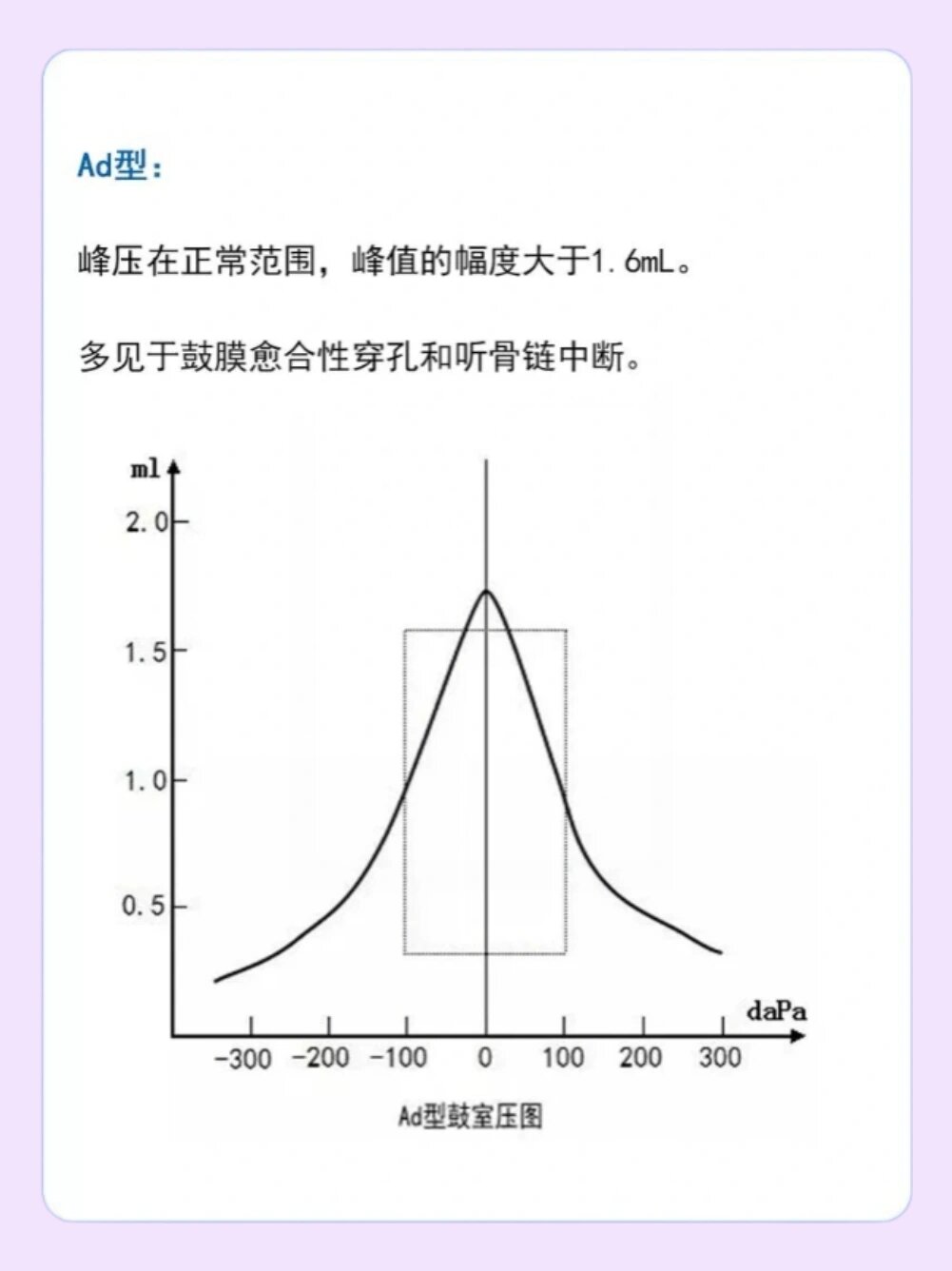 声导抗报告怎么看 很多朋友做了声导抗但是看不懂代表什么意思,判断不