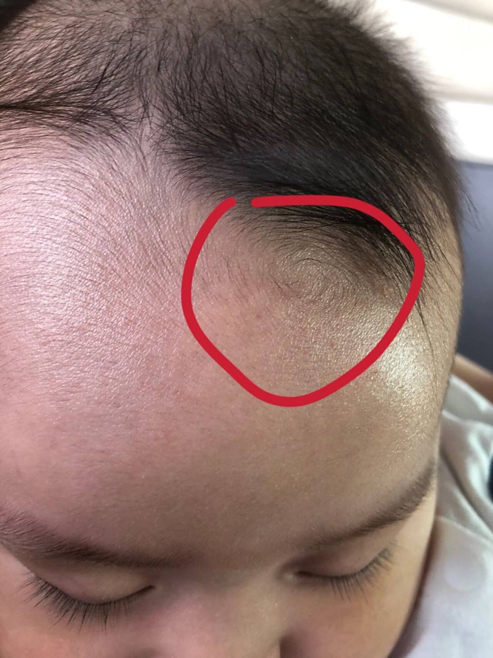 小宝宝额头有个小漩涡咋回事呀?