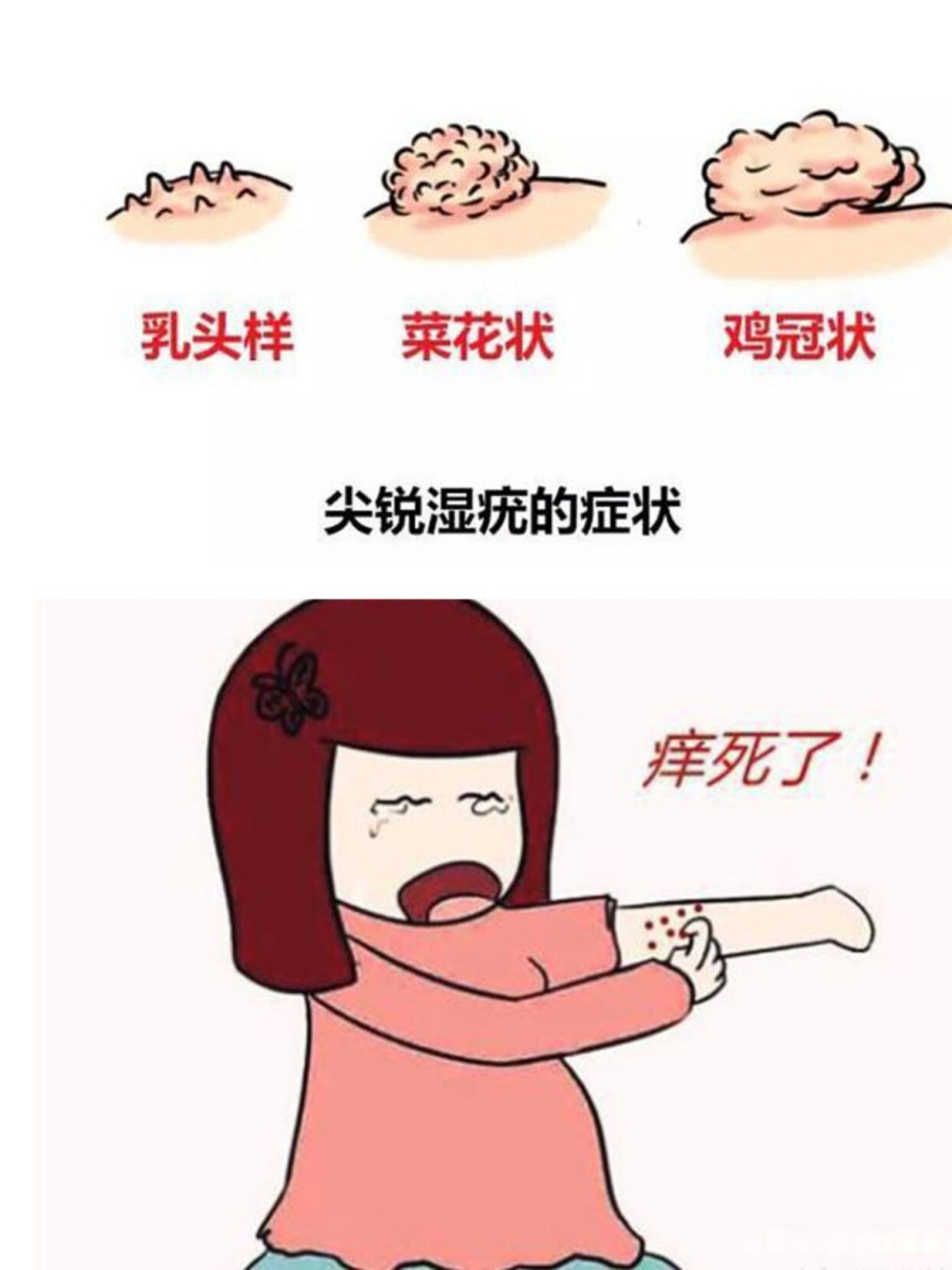 女性身上出现的"小红点",可能感染了hpv 女性的皮肤