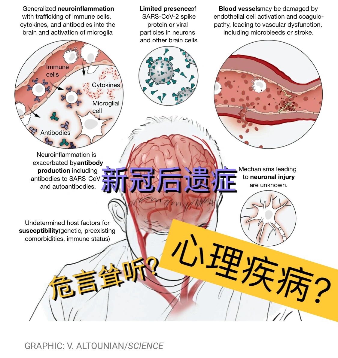 关于新冠后遗症 最近在science上看到疫情以来关于长新冠的最有意义的