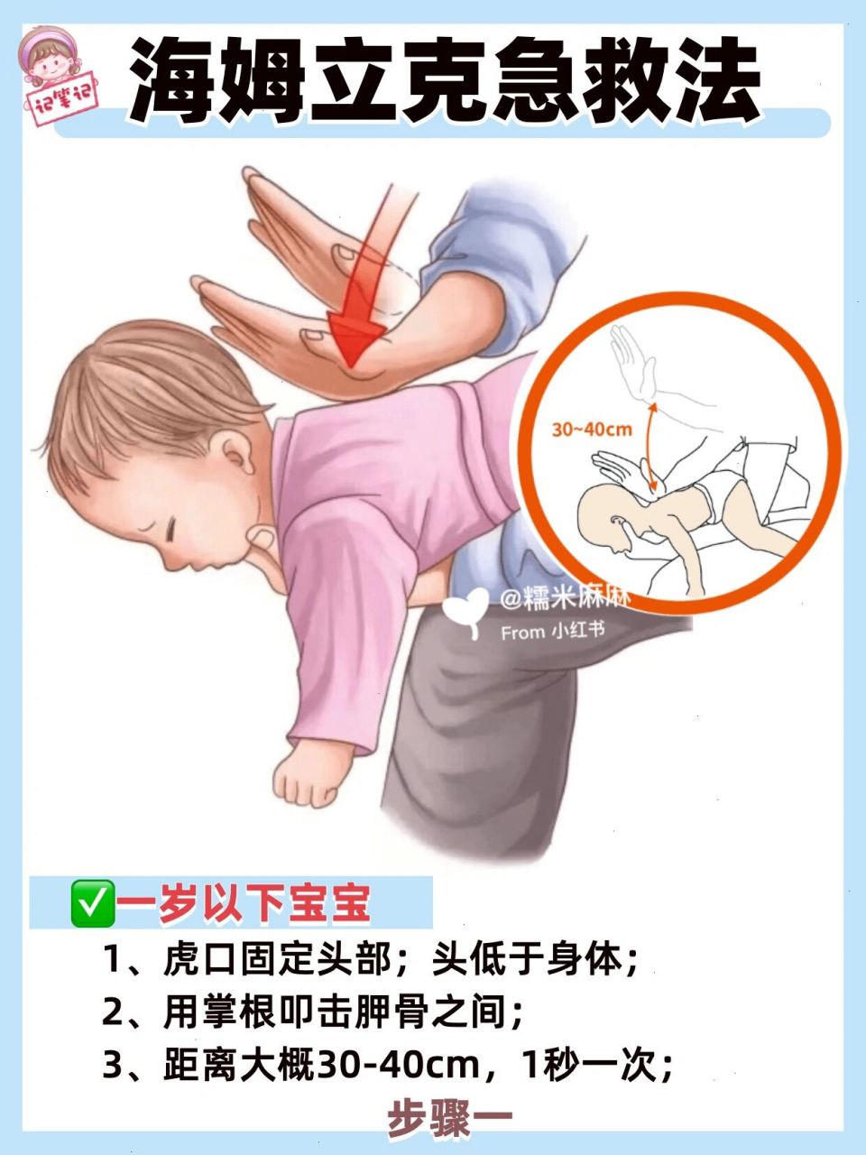 海姆立克急救法92一定要学的异物卡喉急救法 前几天又听说有孩子被