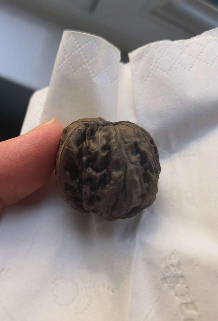 阴皮核桃?  开青皮以后核桃乌黑色,懂的友友指导一下,这是阴皮吗?