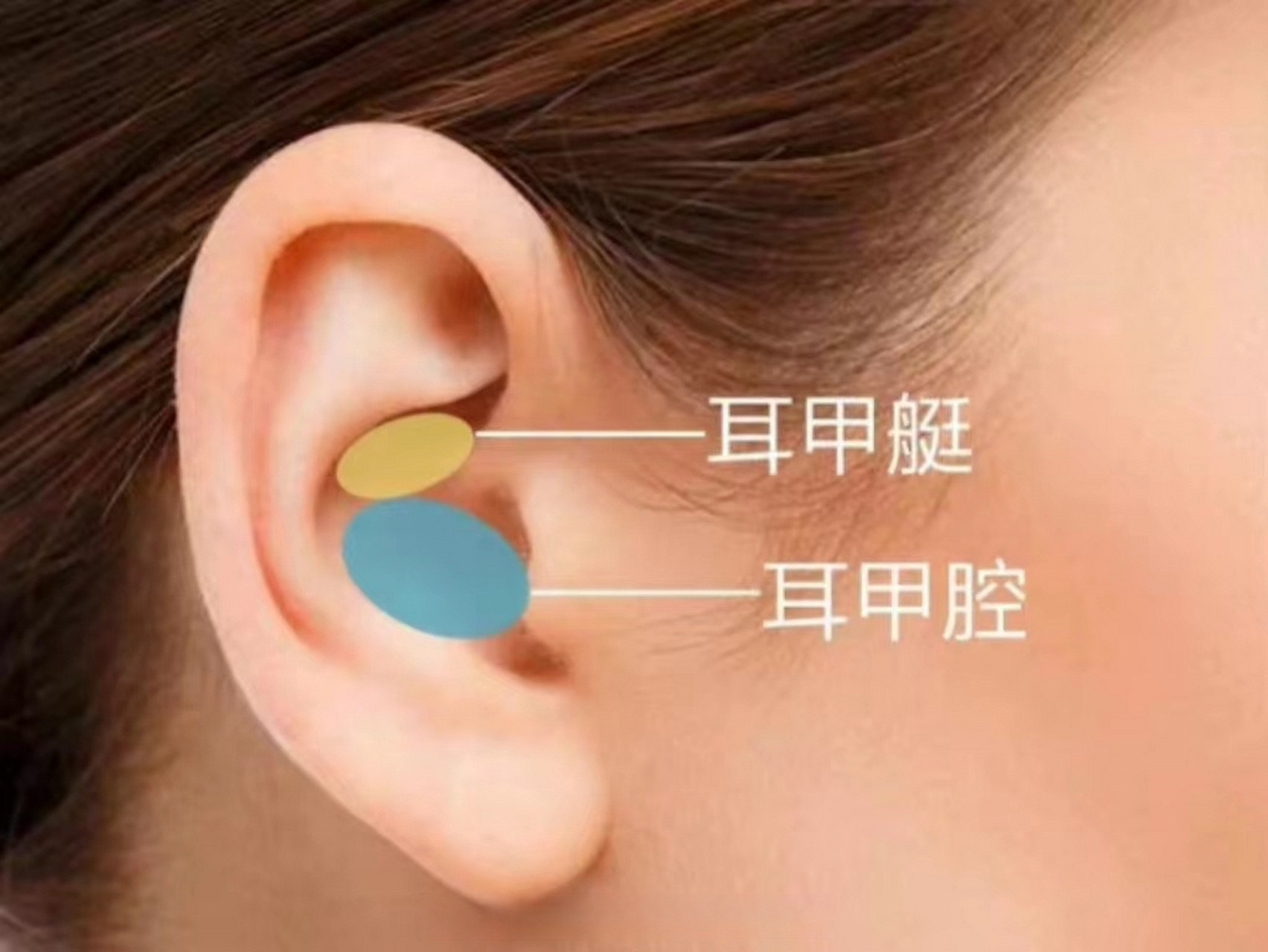 一般这种情况是可以规避的,隆鼻手术取耳软骨一般取耳甲艇或耳甲腔