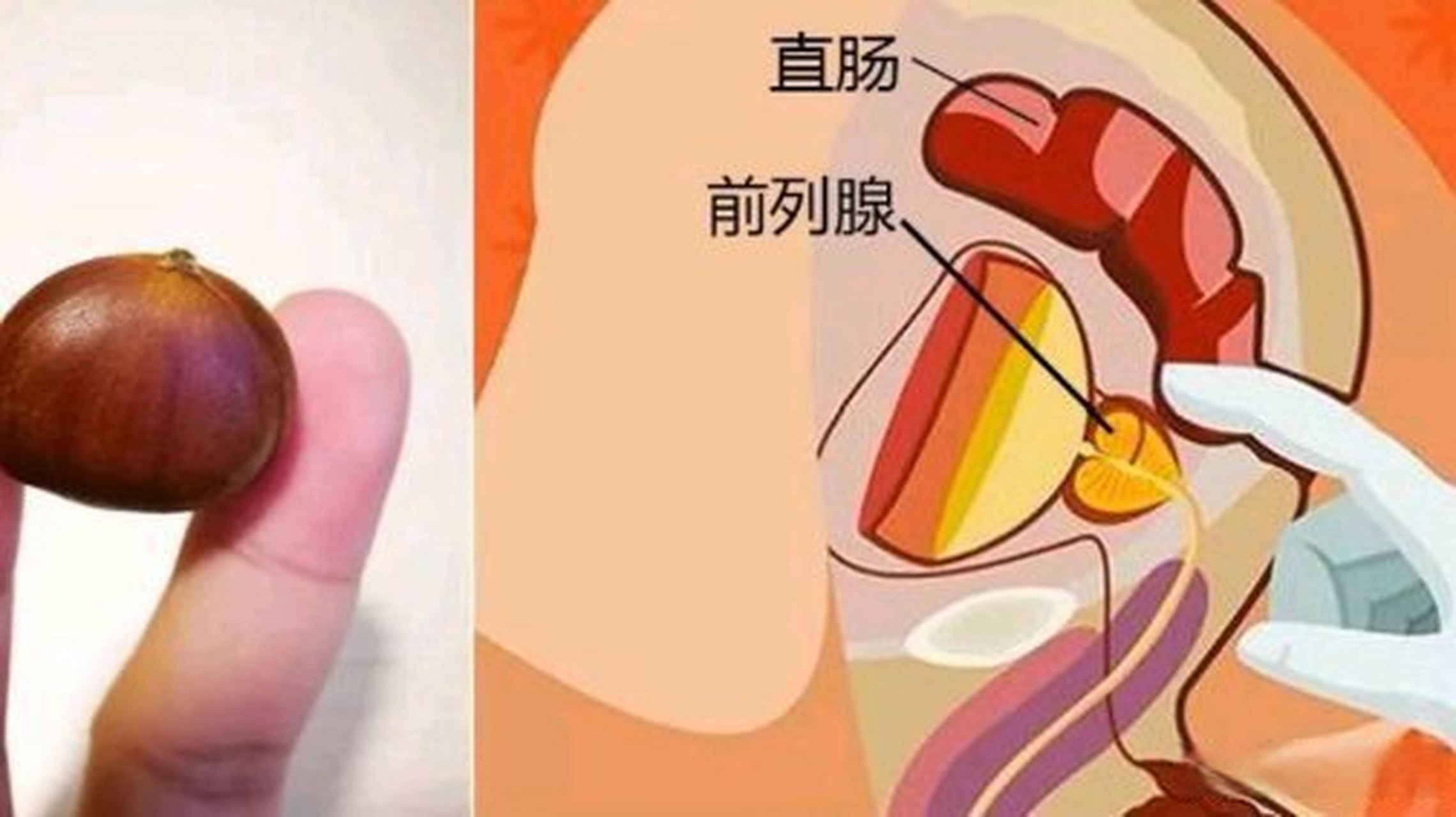 这篇文章很有意思《女人也有前列腺,同男人一样,会产生前列腺素》