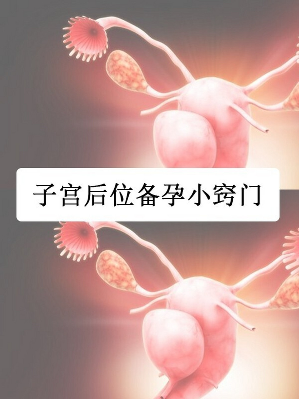 女性子宫后位备孕的小窍门 01子宫后位增加受孕几率可以采取以下