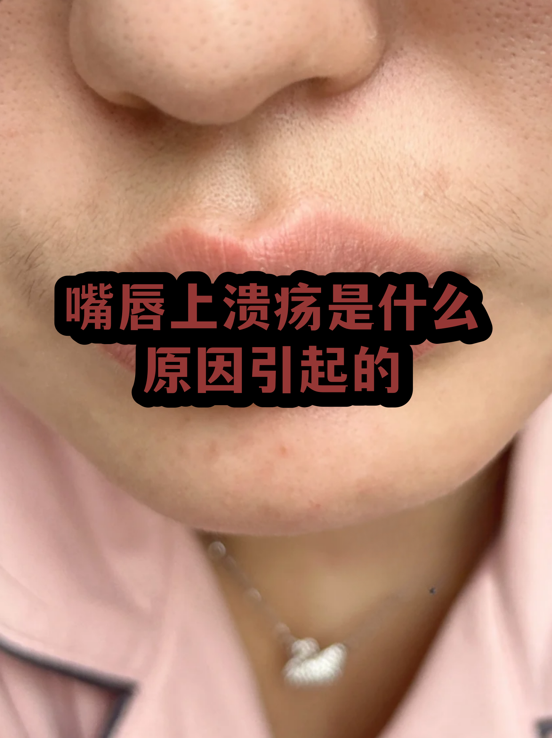  病毒和牙齿会发生什么变化(病毒会引起牙痛吗)