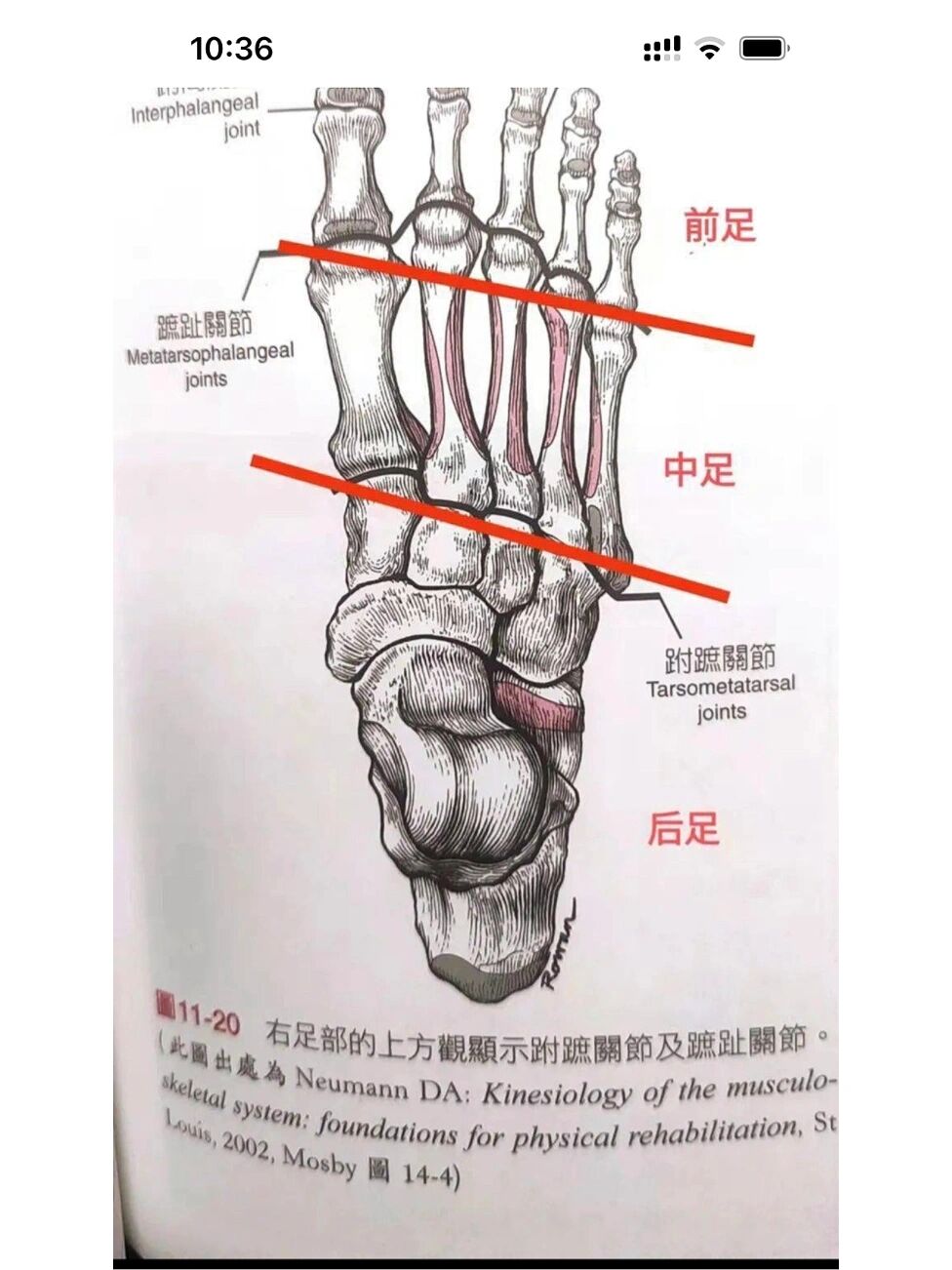 第一跖指关节图片