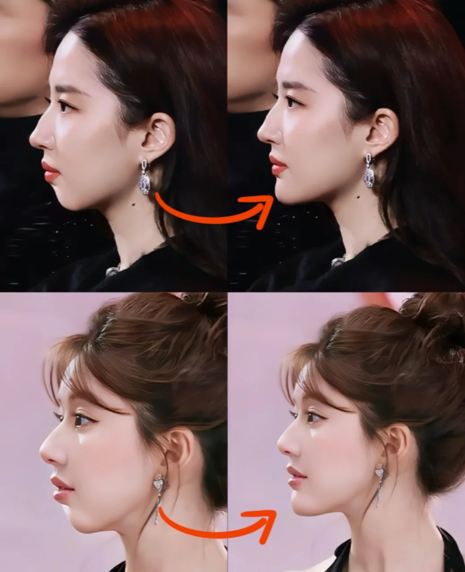 凸嘴侧脸和正常侧脸下巴前倾面相下巴后缩明星对比图下巴侧面看起来