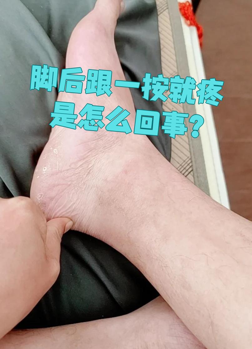 脚后跟一按就疼最常见的原因是跟腱炎或足底筋膜炎