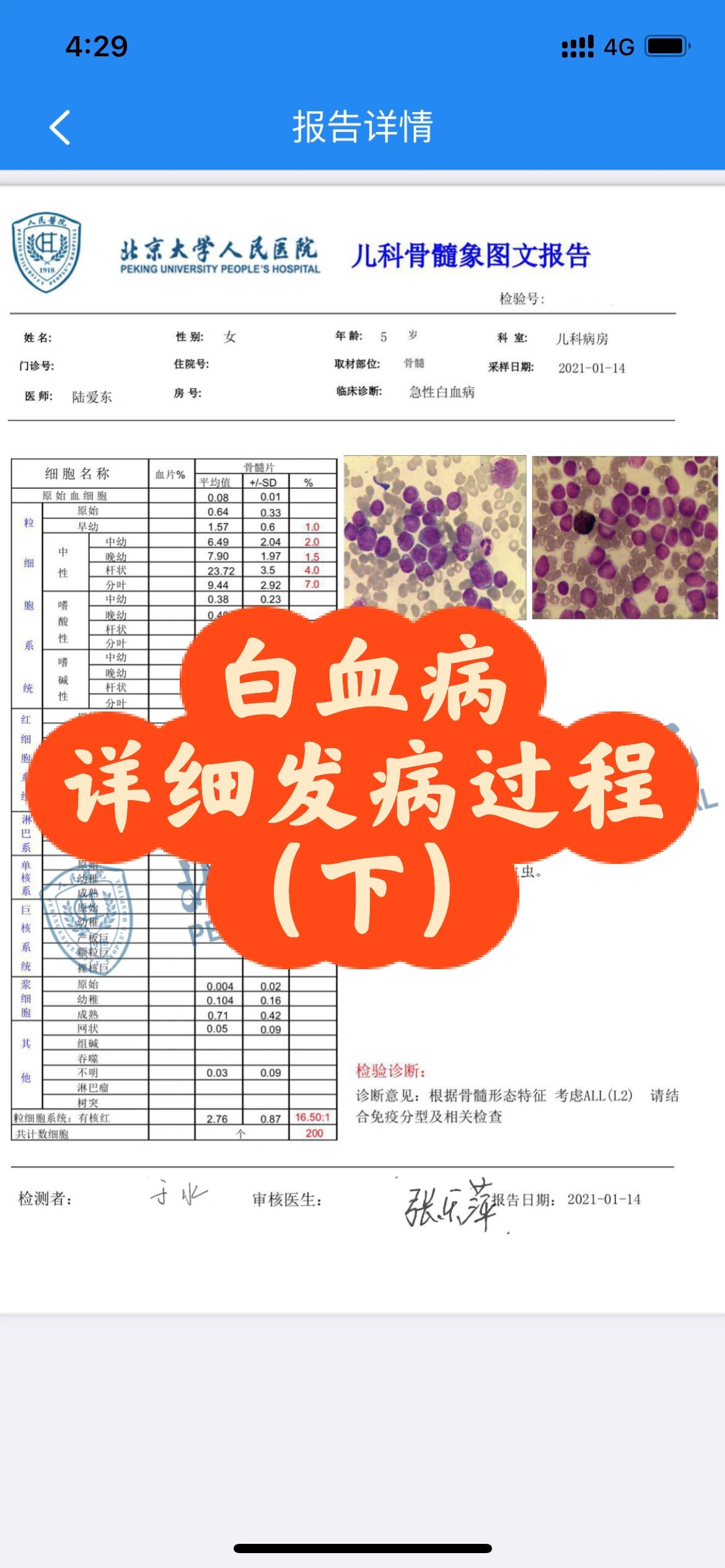 为何会得白血病/白血病原因/详细发病过程下 96白血病发病阶段